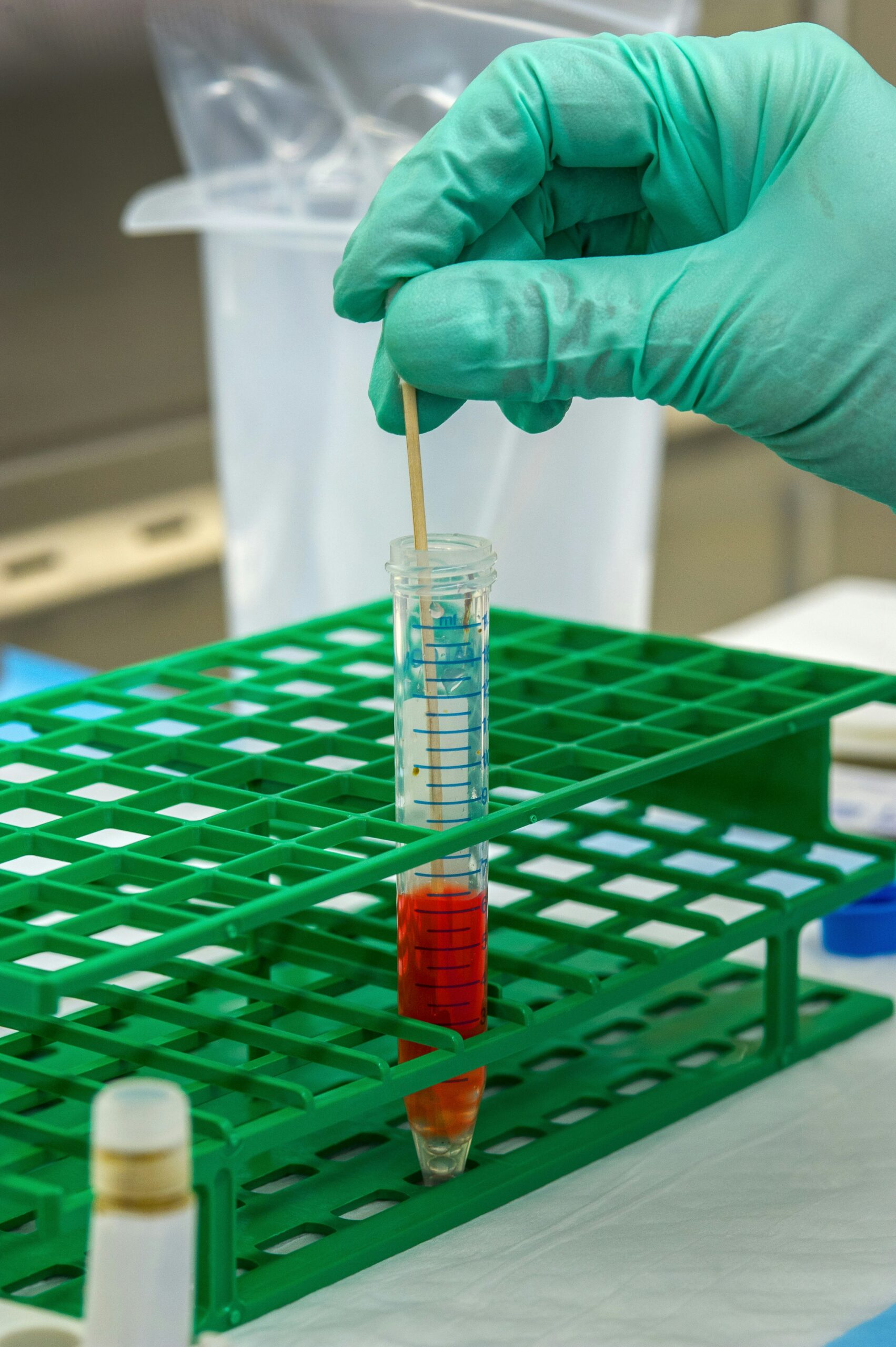 Diagnóstico e Estadiamento da Fibrose Hepática