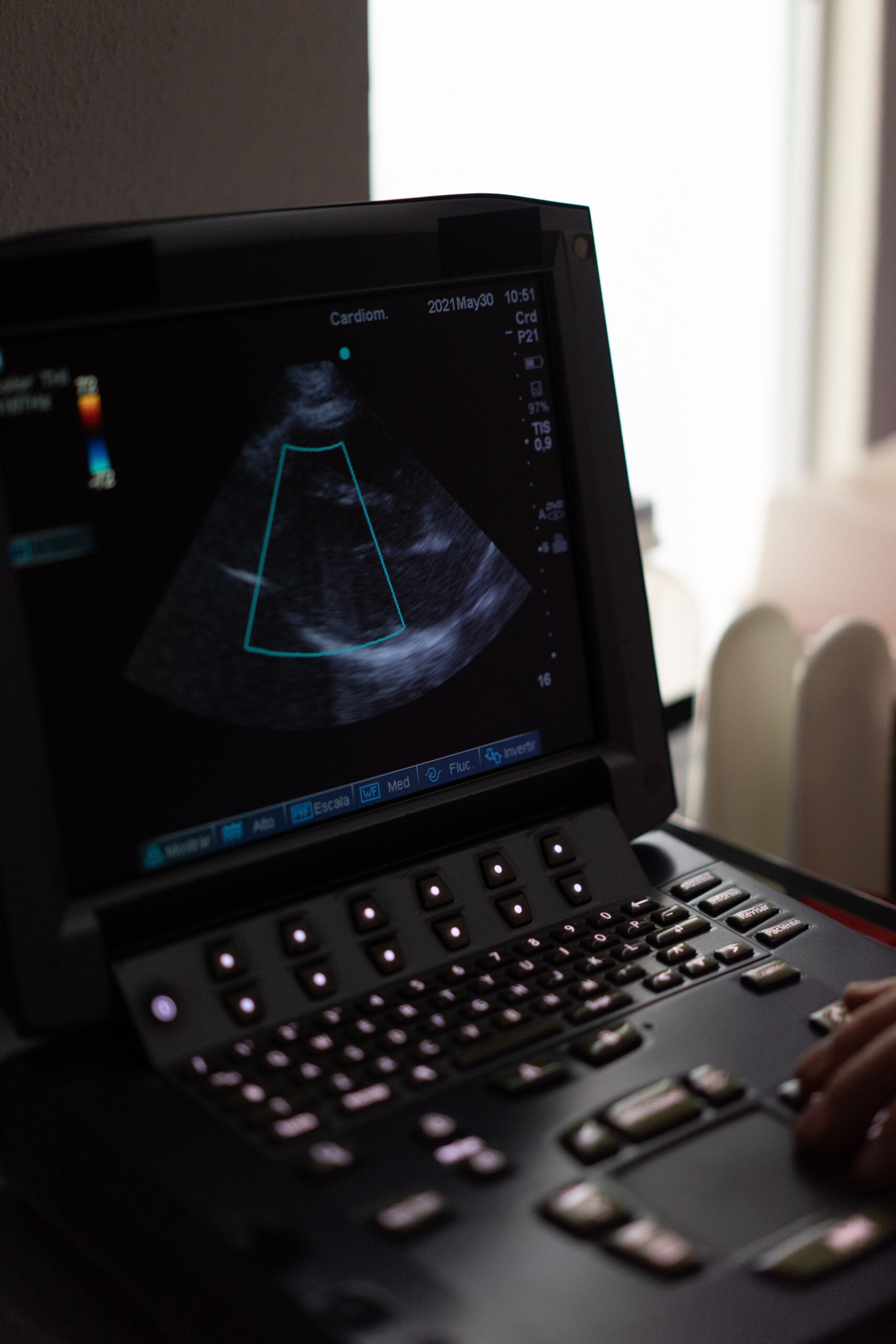 Diagnóstico e Estadiamento da Fibrose Hepática
